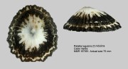 Patella lugubris